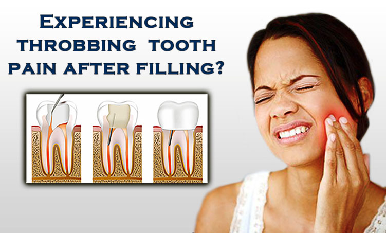 throbbing tooth pain after filling