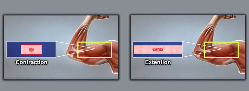 Contraction and Extension