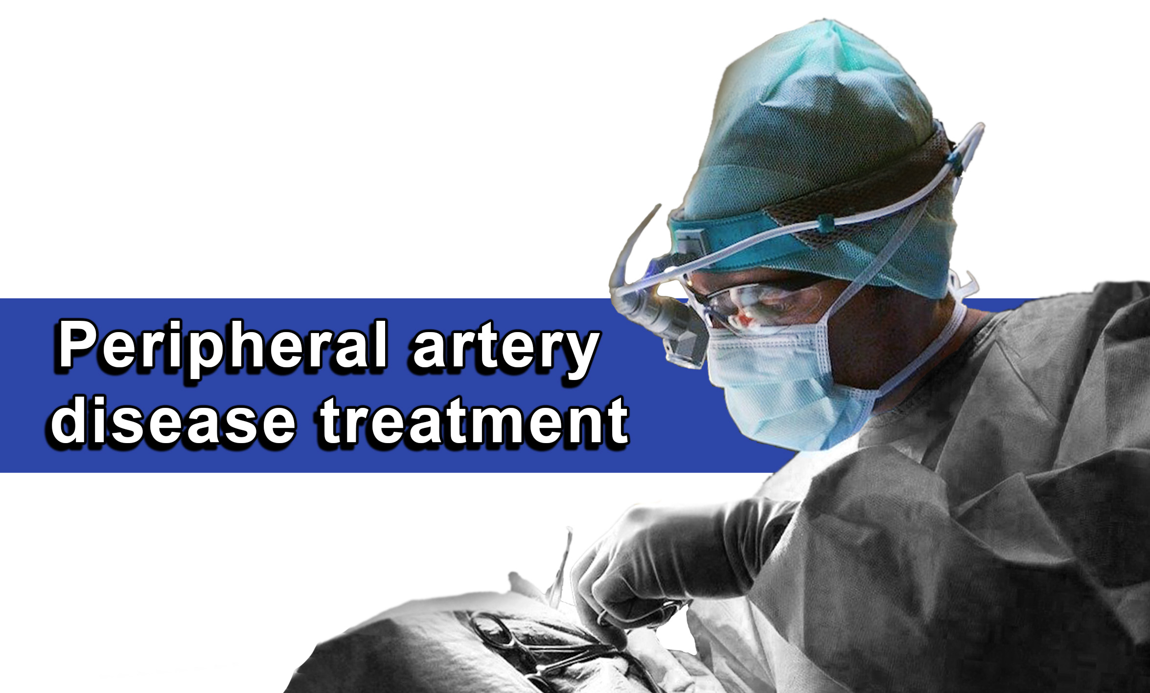 Peripheral artery disease treatment