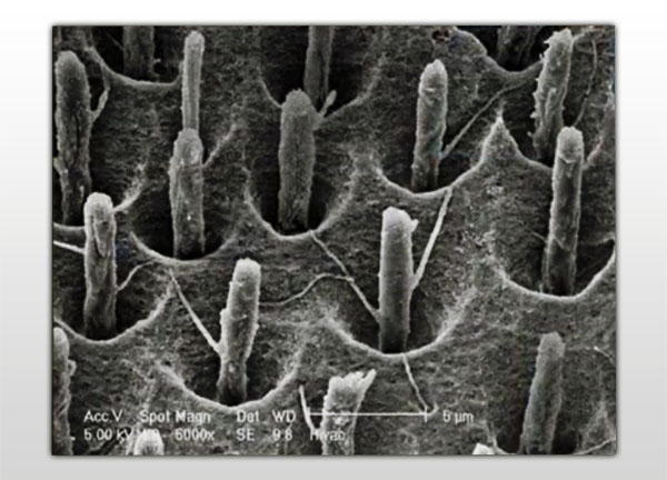 You don't want to dry out the little nerve endings inside of there