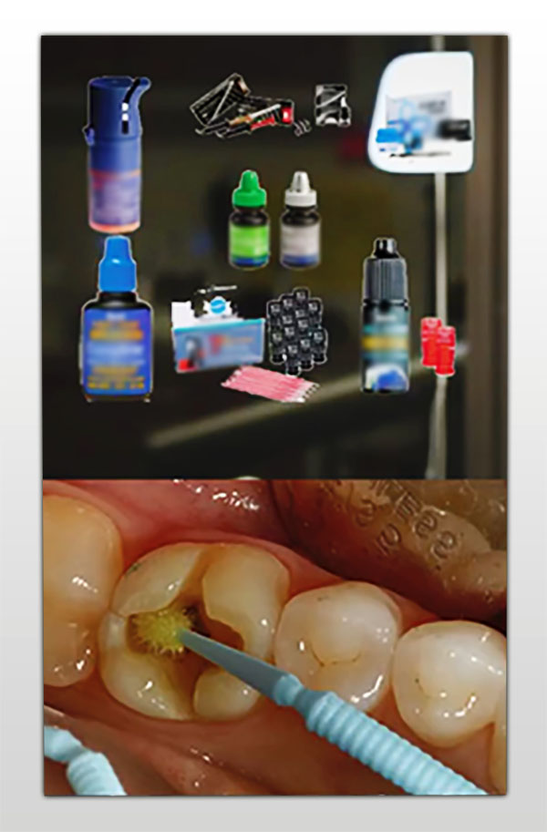 Binding agent and using them to clean teeth