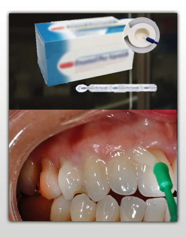 Apply toothpaste on the affected area