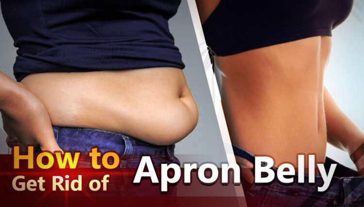 How to get rid of apron belly