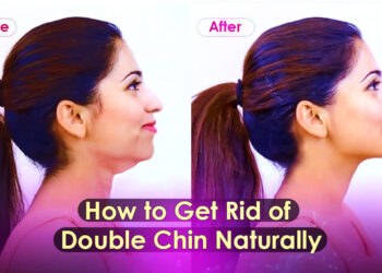 How to get rid of double chin naturally