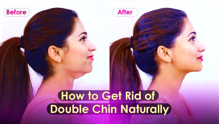 How to get rid of double chin naturally