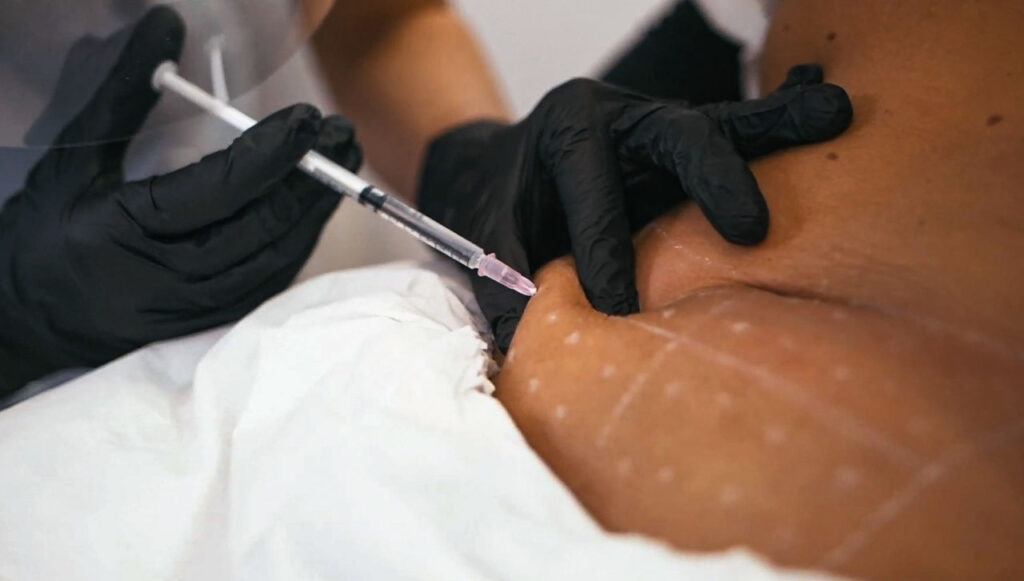 Injectable treatments