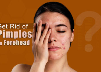 How to get rid of Bumps on Forehead