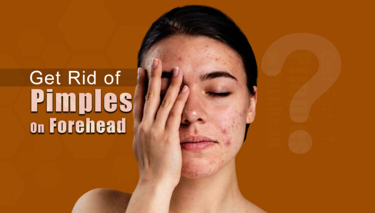 How to get rid of Bumps on Forehead