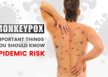 Monkeypox Symptoms And Important Things You Should Know