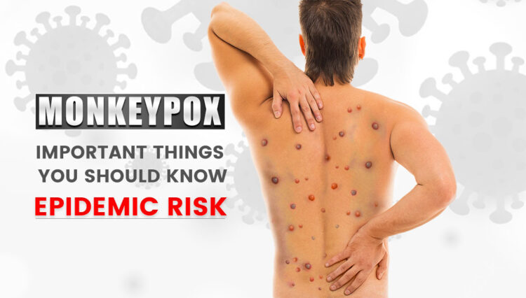Monkeypox Symptoms And Important Things You Should Know