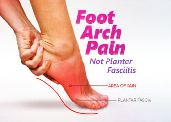 Foot Arch Pain Not Plantar Fasciitis