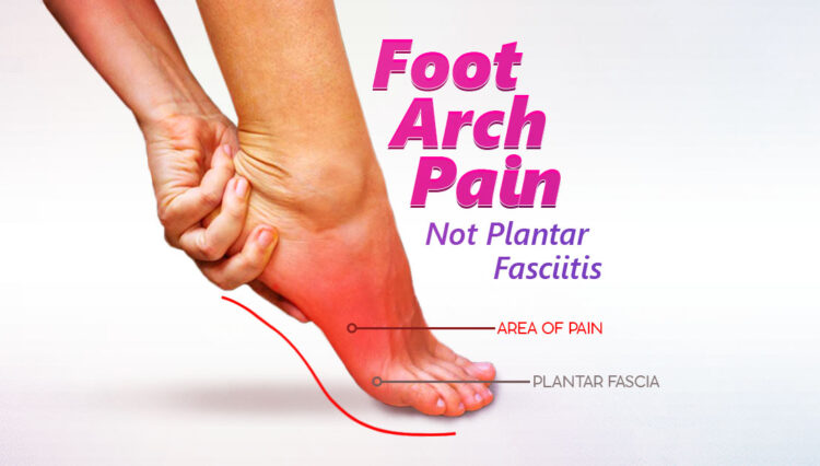 Foot Arch Pain Not Plantar Fasciitis