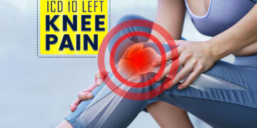ICD 10 Left Knee Pain