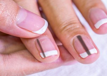 How to Get Rid of Black Lines on Nails