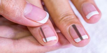How to Get Rid of Black Lines on Nails